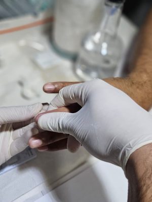 Dezembro Vermelho 2025: Amazonas registra queda de 20,7% na mortalidade por Aids e amplia ações de prevenção